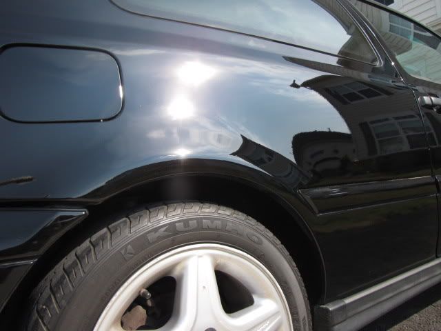 MyGTICorrectionduringandafterpic-75.jpg