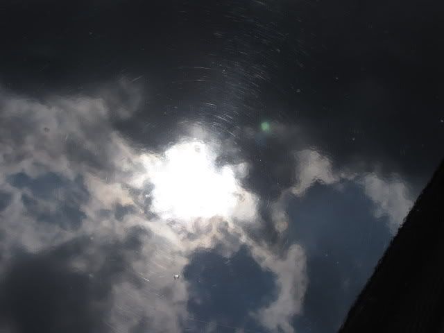 MyGTICorrectionduringandafterpics03.jpg